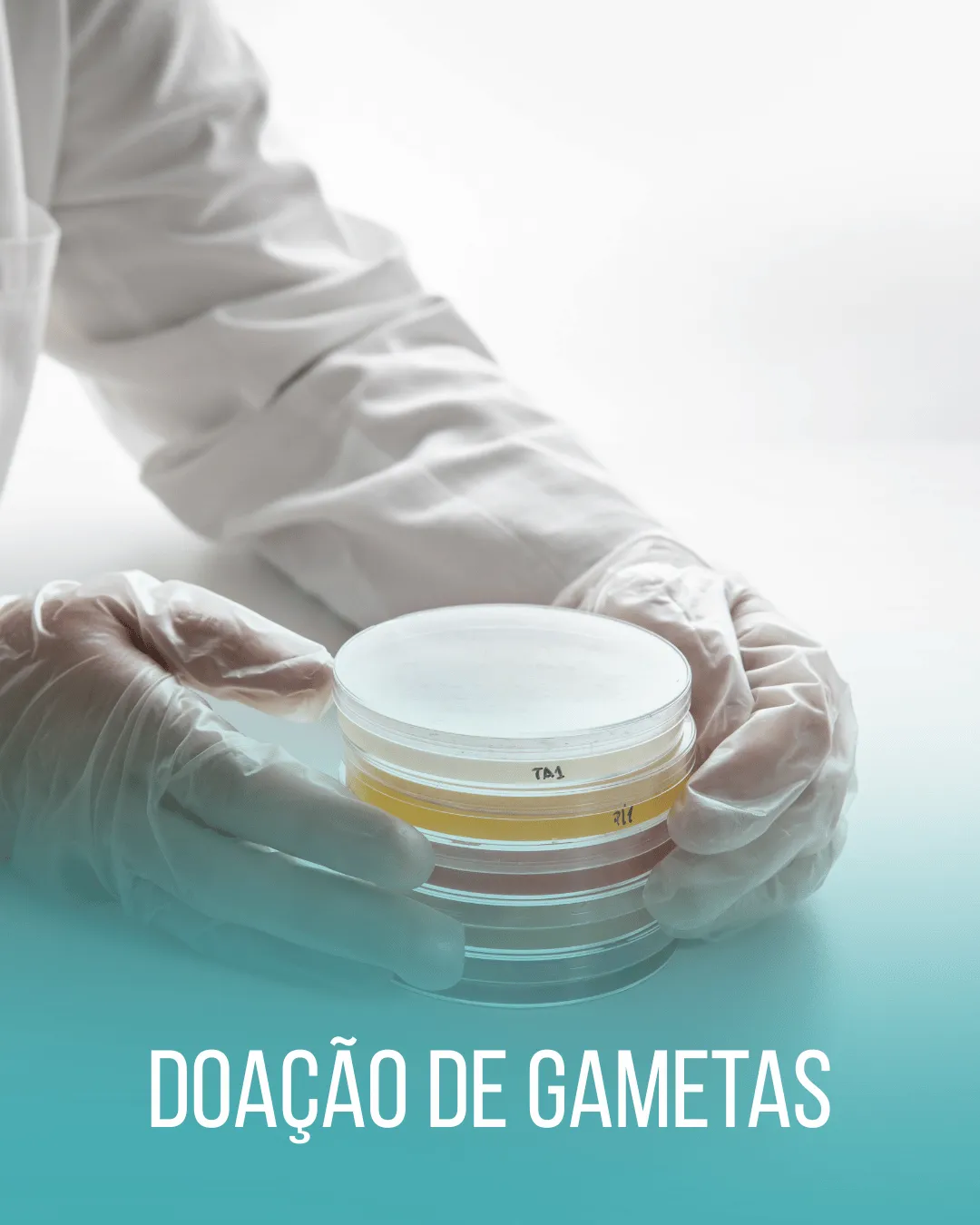 Doação de gametas